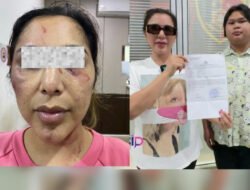 Selebgram Asal Singkawang Gebby Vesta Laporkan HS ke Polresta Pontianak Diduga Penganiayaan